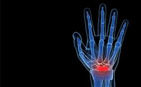Detecting Nerve Damage and Staying Healthy